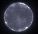 vesicula