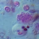 bacterias purpuras