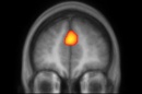 cortex medio prefrontal