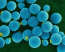 cryptococcus neoformans