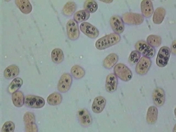 Resultado de imagen de bacterias del azufre